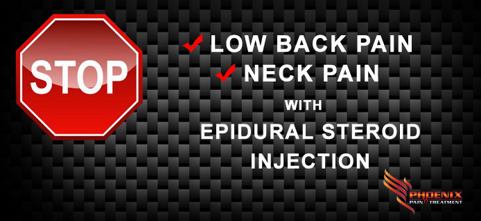 Epidural-Steroid-Injection
